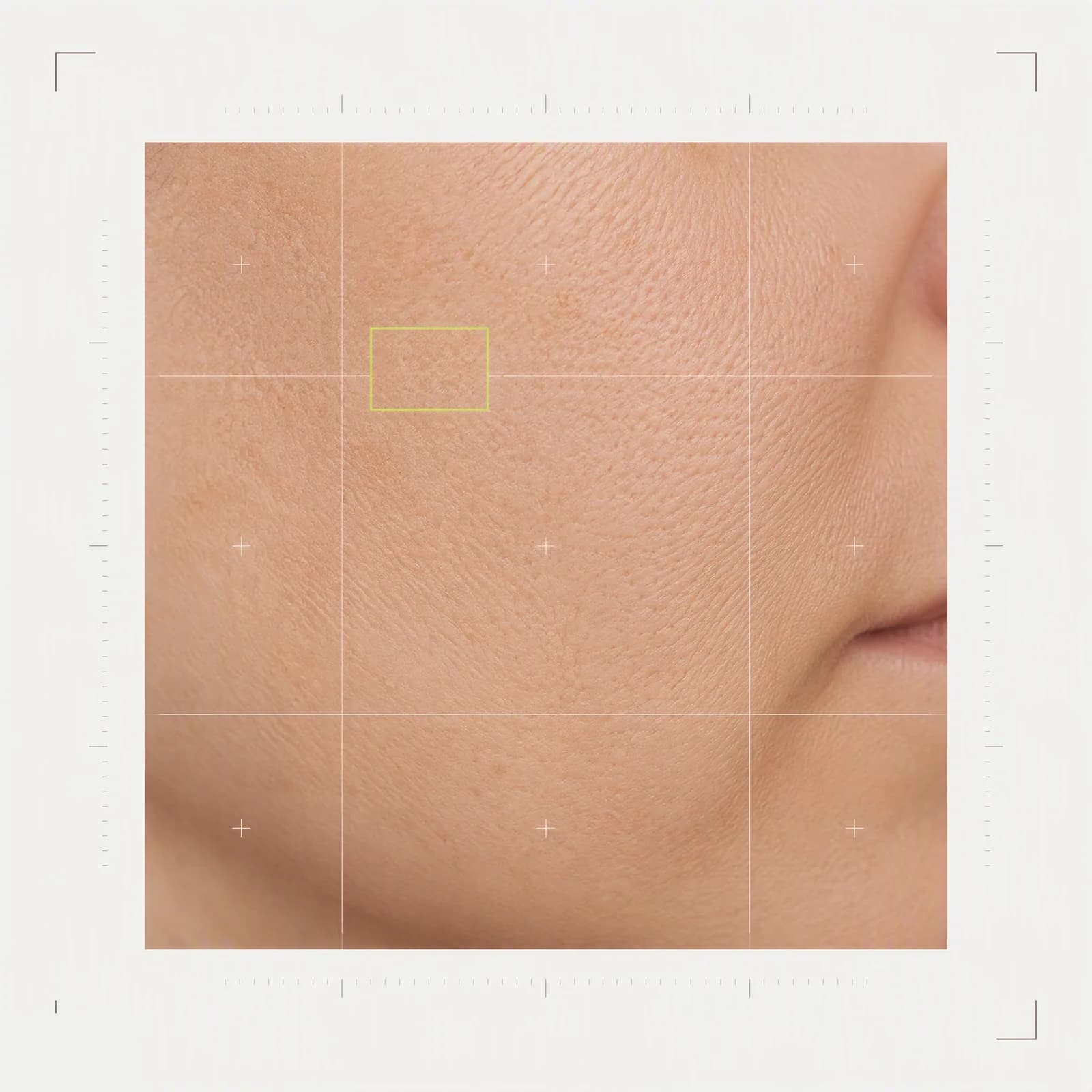Macro fragment of skin under a clinical annotation grid; one analysed area marked